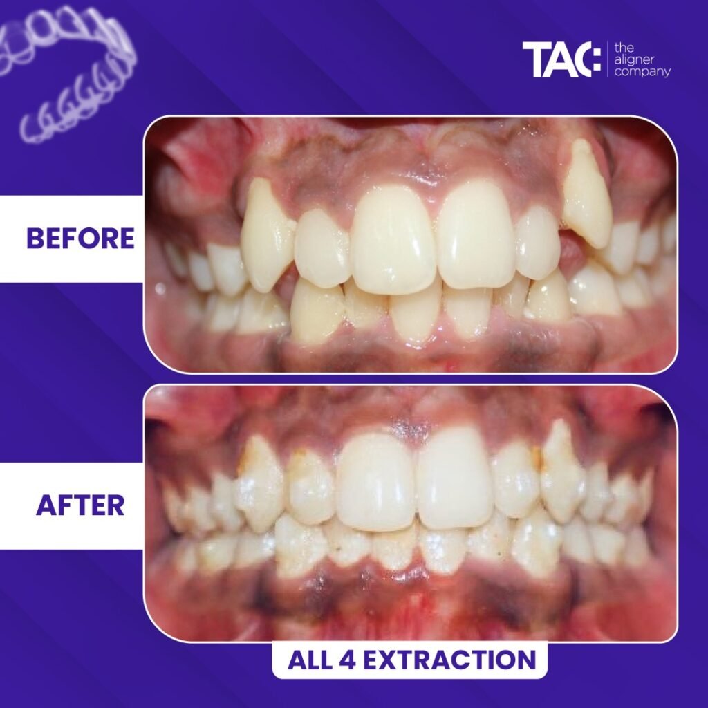 tac images